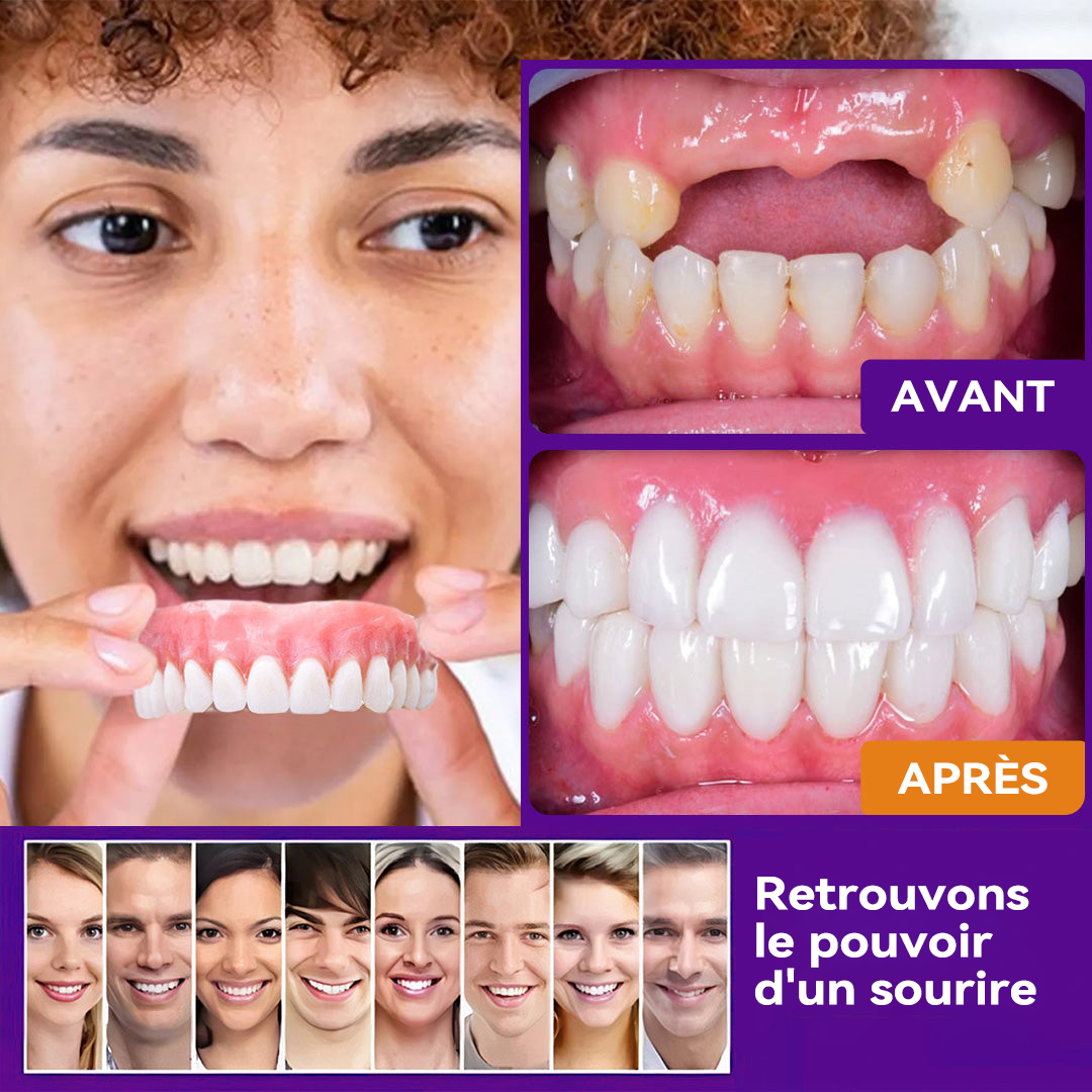 Schneider - Ensemble de Dentiers en Silicone