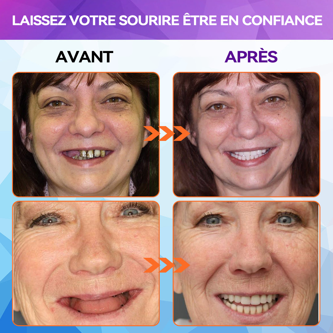 Schneider - Ensemble de Dentiers en Silicone