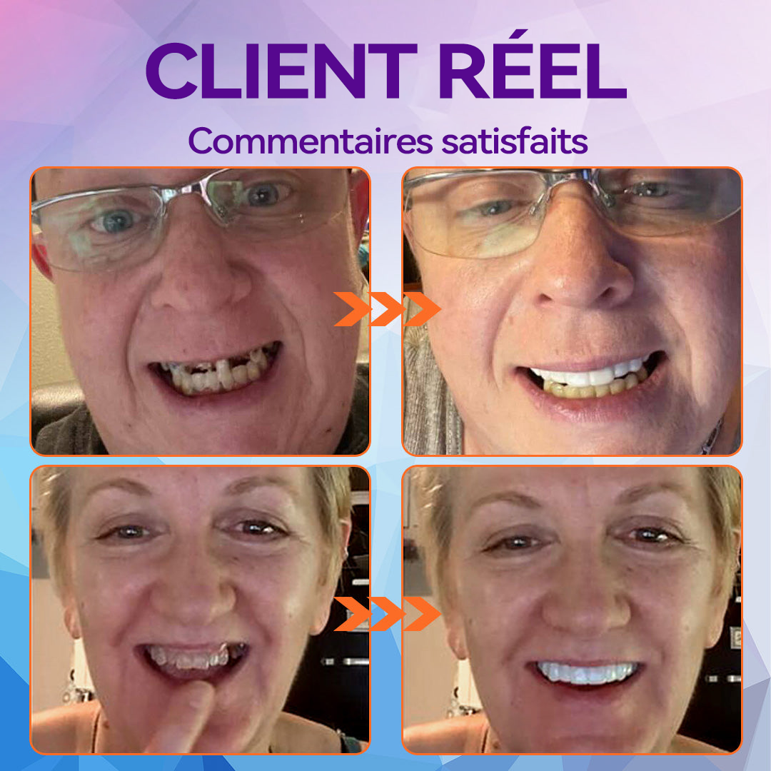 Schneider - Ensemble de Dentiers en Silicone