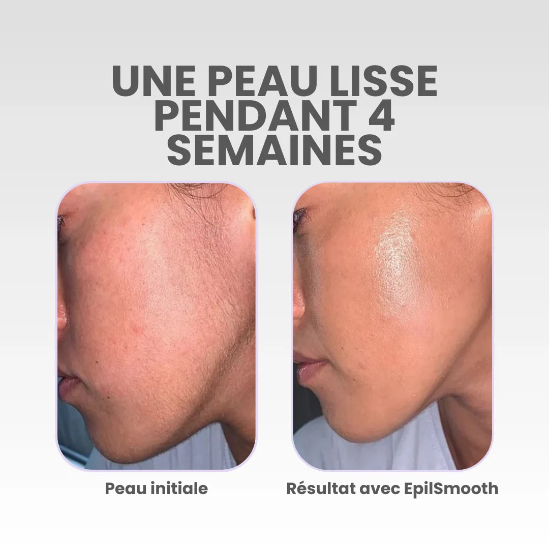 EpilSmooth⎪Épilateur pour le visage